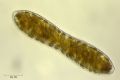 Cymatopleura solea