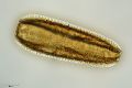 Surirella robusta