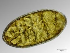 Surirellaceae
