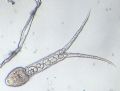 Trematoda