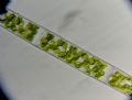 Spirogyra sp.