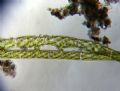 Spirogyra sp.