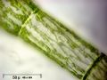 Sirogonium sp.