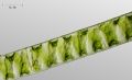Spirogyra sp.