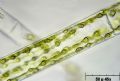 Sirogonium sp.