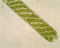 Spirogyra sp.